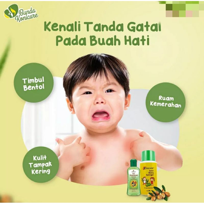 Konicare Bedak Gatal Biang Keringat 90 gr anak dewasa