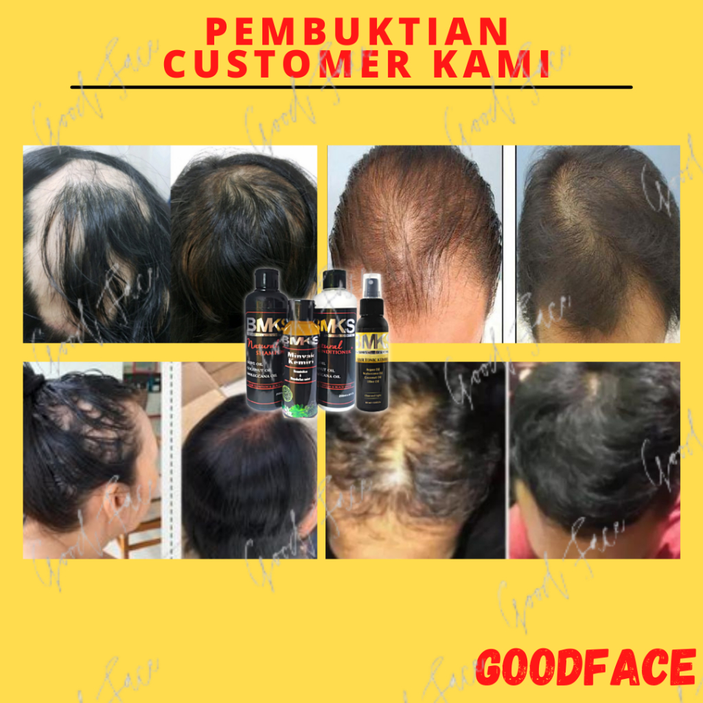 PENUMBUH RAMBUT AMPUH BMKS PAKET 4IN1 SHAMPO- CONDITIONER - MINYAK KEMIRI - HAIR TONIC BPOM