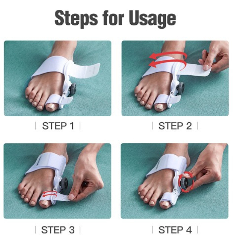 CORRECTOR BUNION PELURUS JEMPOL KAKI Adjustable Knob [BJK-P]