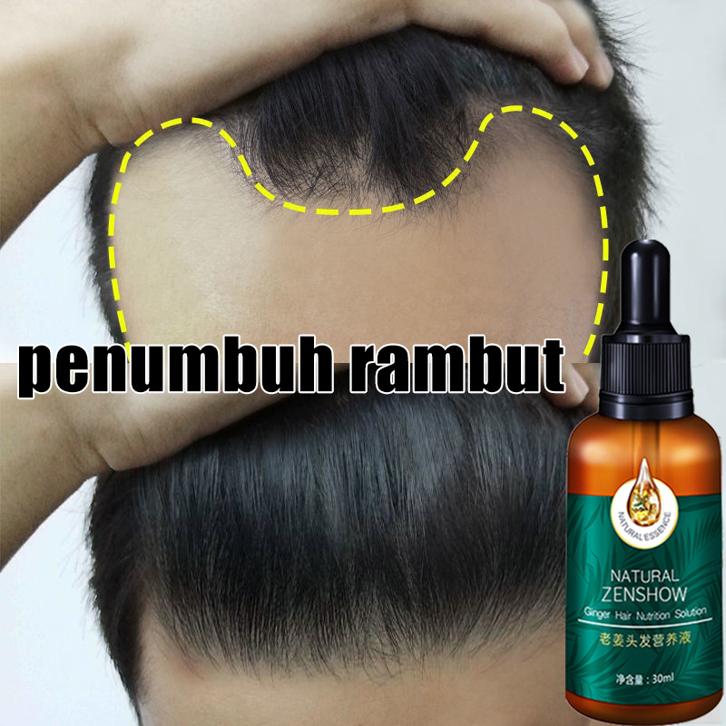 Serum penumbuh rambut hair growth Serum Anti Rambut Rontok penumbuh rambut botak dan rontok serum ra
