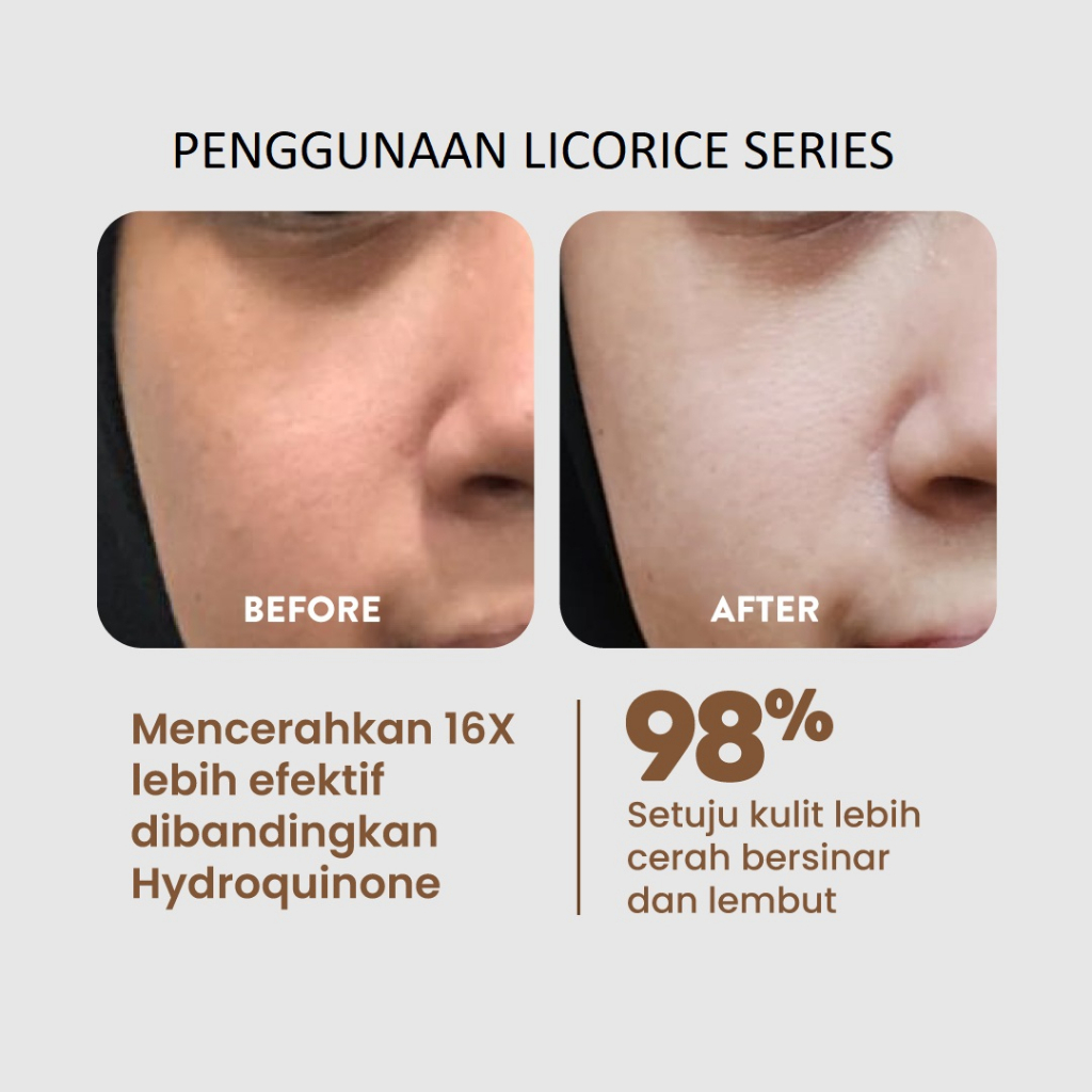 NPURE Licorice Cica Centella Asiatica Noni Probiotics Series Face Toner Serum Clear Pad Serum Day Night Beat the Sun Powder Cleanser N' Pure