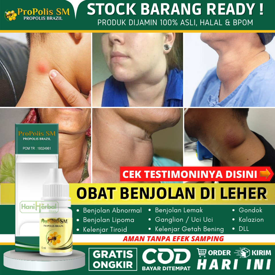 [COD] Obat Untuk Benjolan di Leher / Benjolan di Tangan / Benjolan di Alis / Benjolan di Kepala / Be