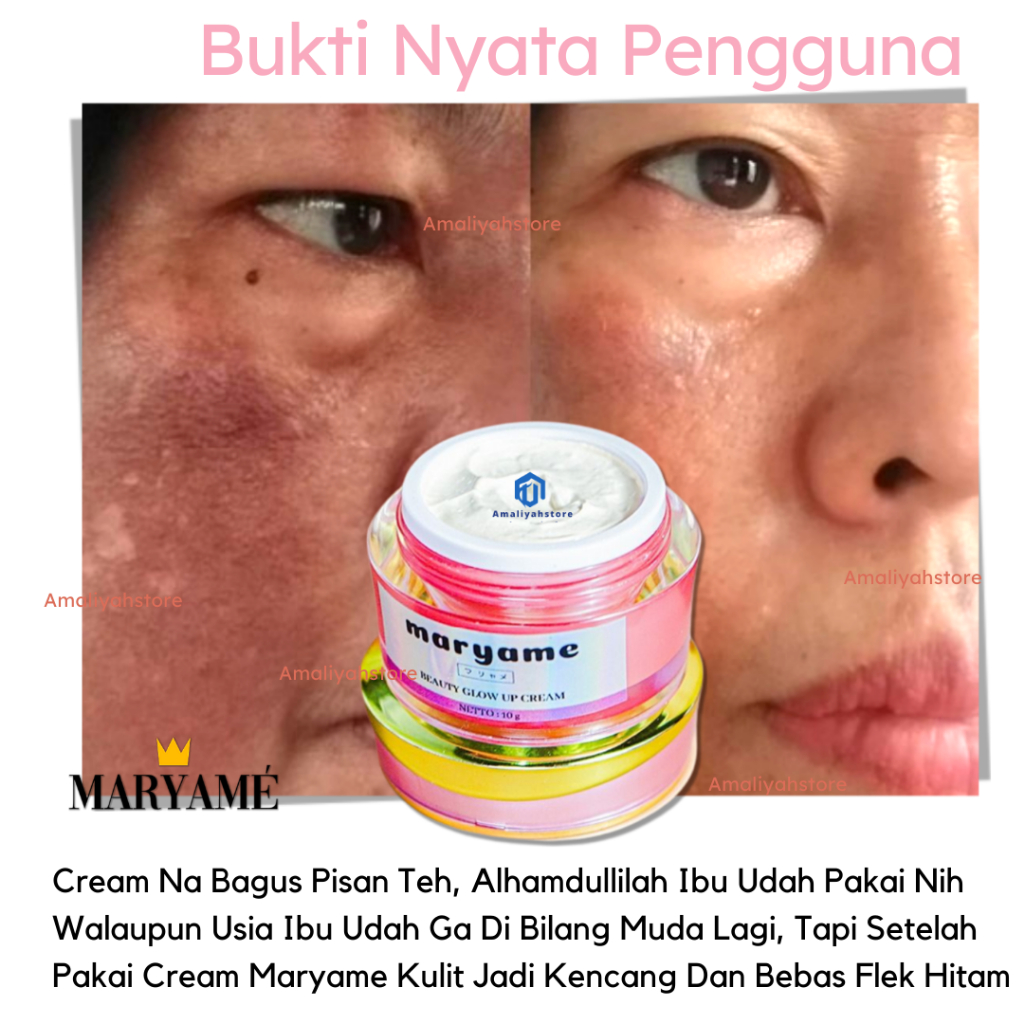 Maryame Beauty Glow Up Cream Skincare Pemutih Wajah Dan Penghilang Bekas Jerawat Anti Flek Hitam Cepat Glowing Permanen 100% Ori