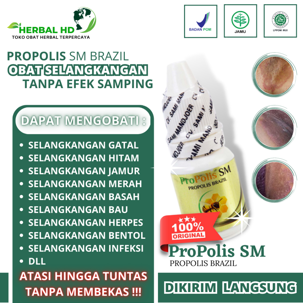 Obat Gatal Di Selangkangan Pria & Wanita - Obat Gatal Di Pantat - Obat Gata Exim dan Gatel Kelamin -