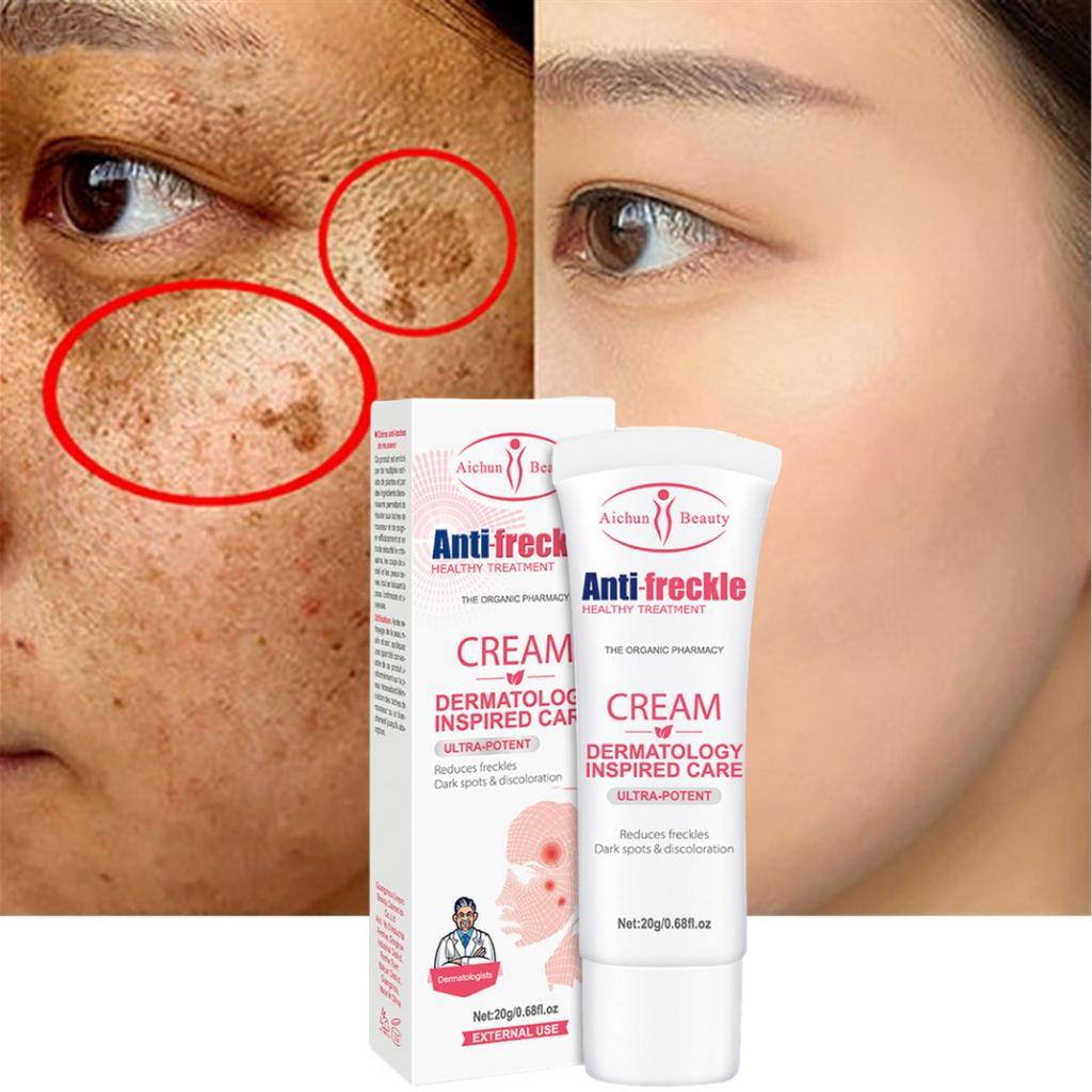 Krim Penghilang Flek Hitam Salep Krim Menghilangkan Bintik-bintik Mencerahkan dan Melembabkan Pemutih Wajah Freckles Removal Cream - 20g