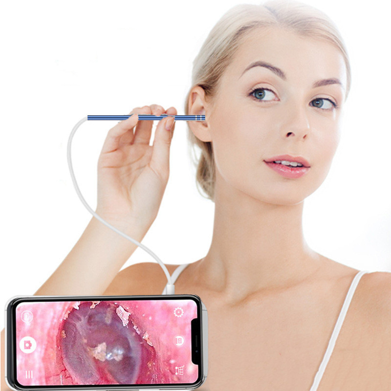 Kamera Endoskopi Pembersih Telinga Otoskop Endoscope HD USB - HUSK-DNEC01