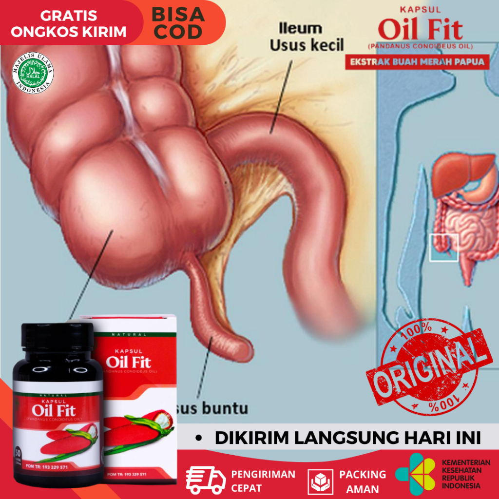 Obat Herbal Usus Buntu, Obat Usus Luka, Obat Infeksi Usus Buntu, Obat Radang Usus Buntu, Obat Penyum