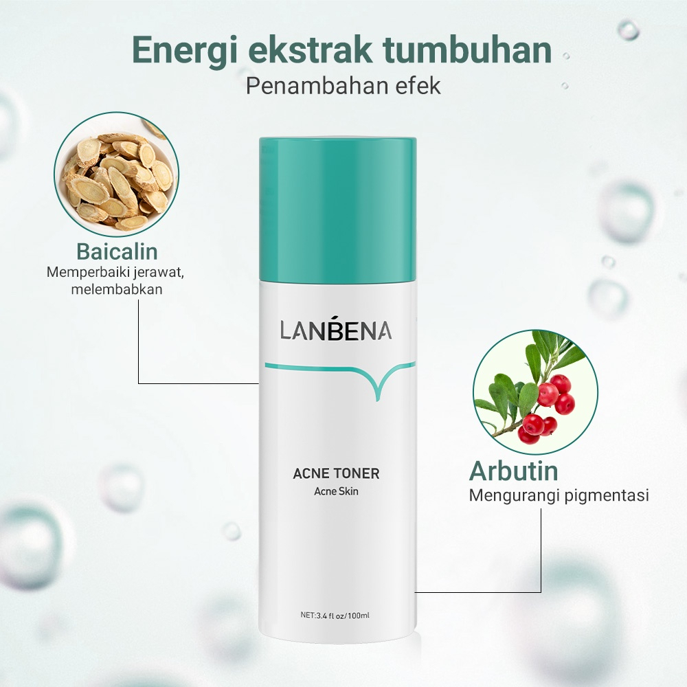 ✨ AKU MURAH ✨ LANBENA Acne Facial Treatment Toner 100 ML