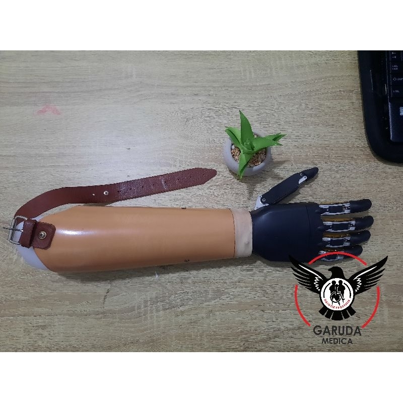 Tangan Palsu Bionic