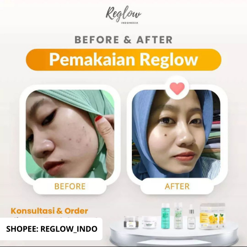 Reglow 2PCS Night Cream + Serum Rglow Skincare Dokter Shindy Original Official Store