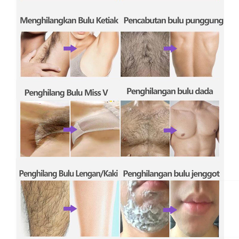 Perontok bulu permanen penghilang bulu ketiak hair removal spray krim penghilang bulu baju 150ML Painless Cepat/tidak iritasi/tidak ada flek hitam Seluruh tubuh tersedia