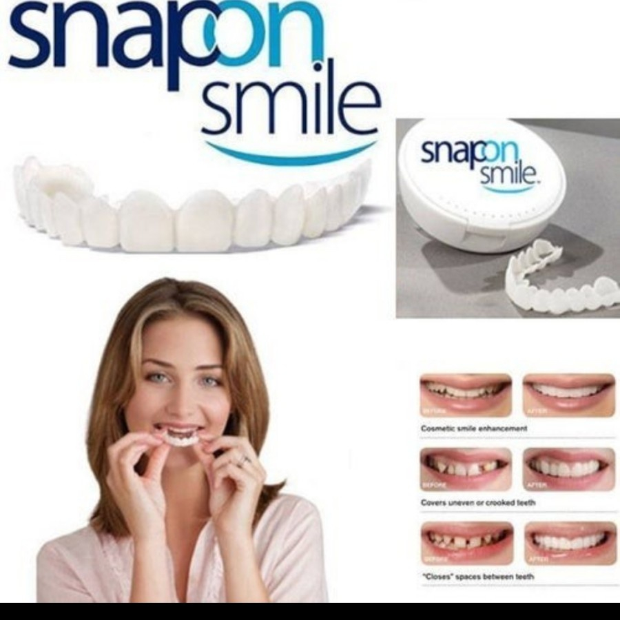 Ready Snap On Smile Veneer Instan Gigi Tiruan Kesehatan Mulut