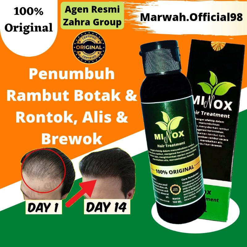 Paket 10 botol Minox Hair Treatment Penumbuh Rambut Botak dan Rontok