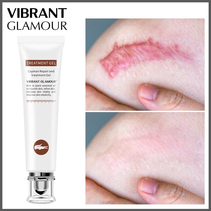 Vibrant Glamour Cayman Repair and Treatment Gel Penghilang Bekas Luka 20gr