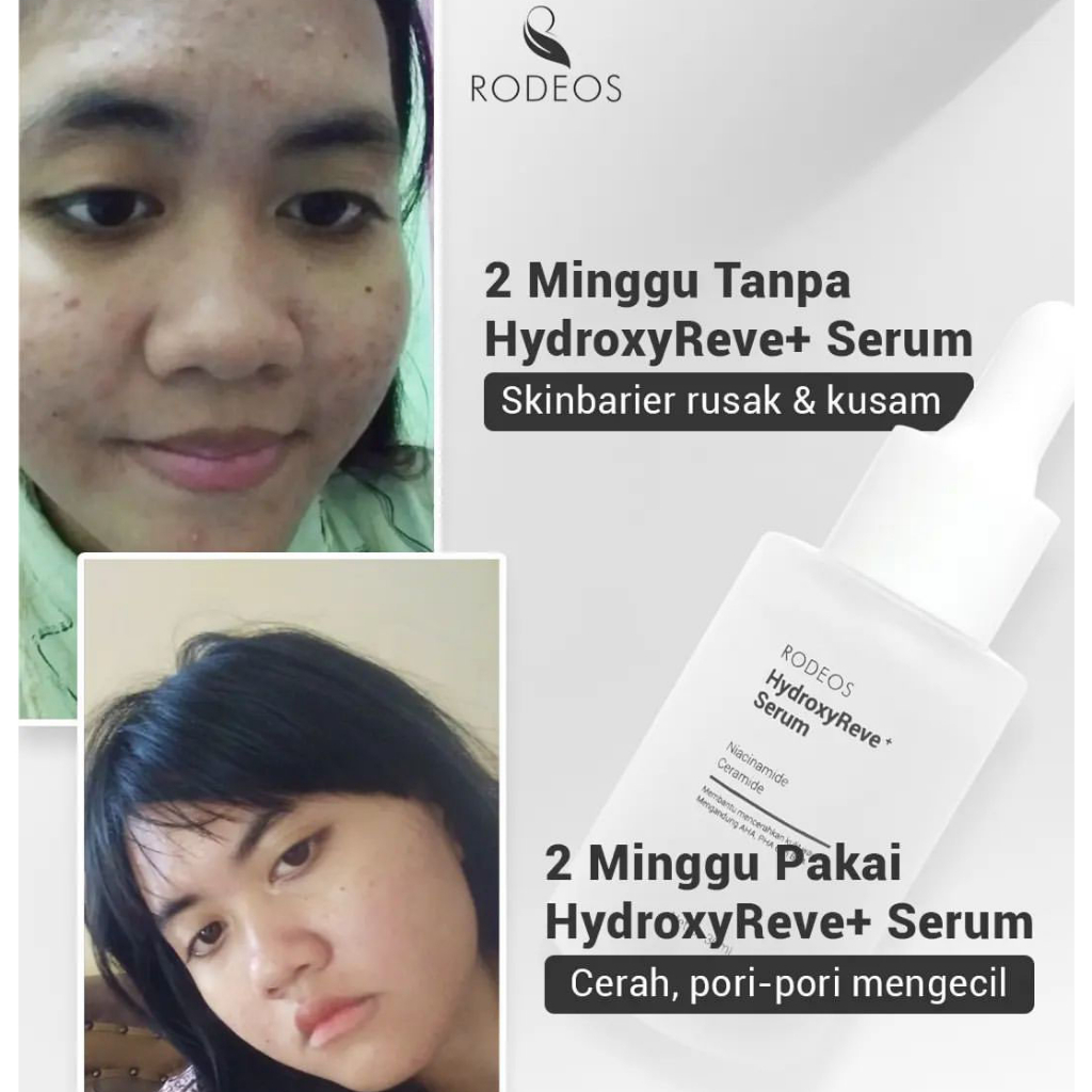 RODEOS Rodeos men Charcoal Soap Sabun Wajah Pria Wanita Anti Jerawat Komedo Kusam