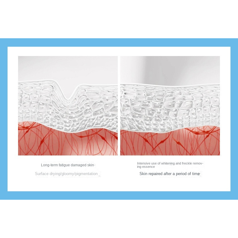 SISKALEY 100ml Nicotinamide Whitening Serum Freckles Remove Dark Spots Melasma Brighten Lighten Melanin Improve Dull Anti-Aging