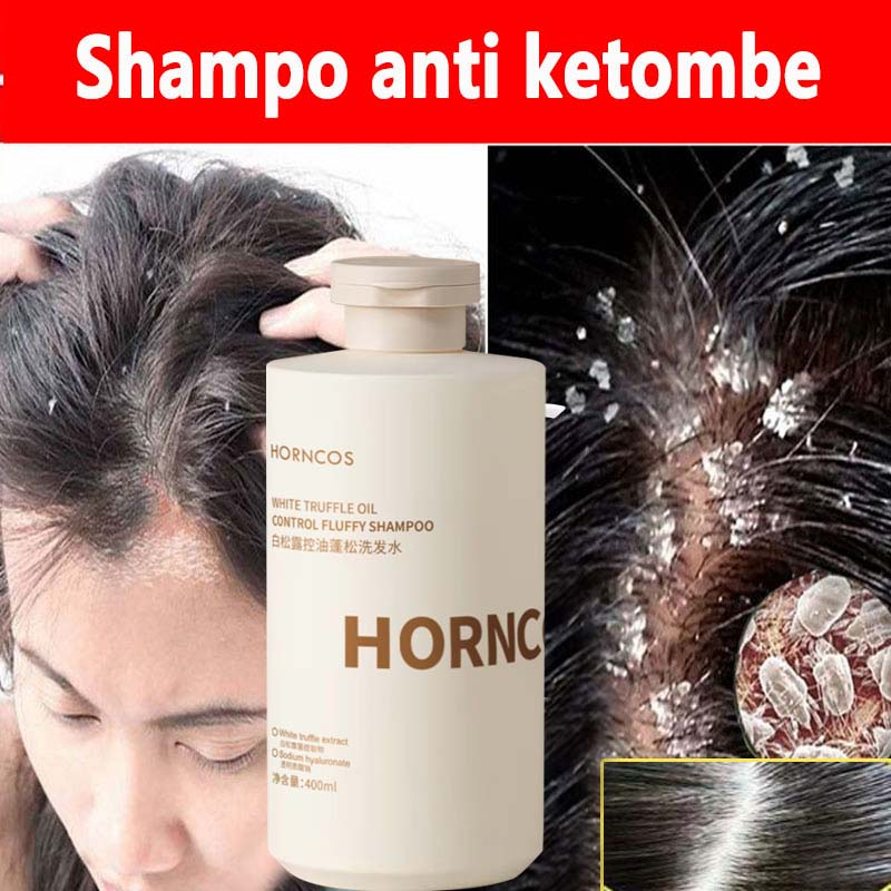 Shampo Anti Ketombe Balsem Shampoo Buat Ketombe Hampoo Penghilang Ketombe Anti Gatal Pengobatan Ketombe