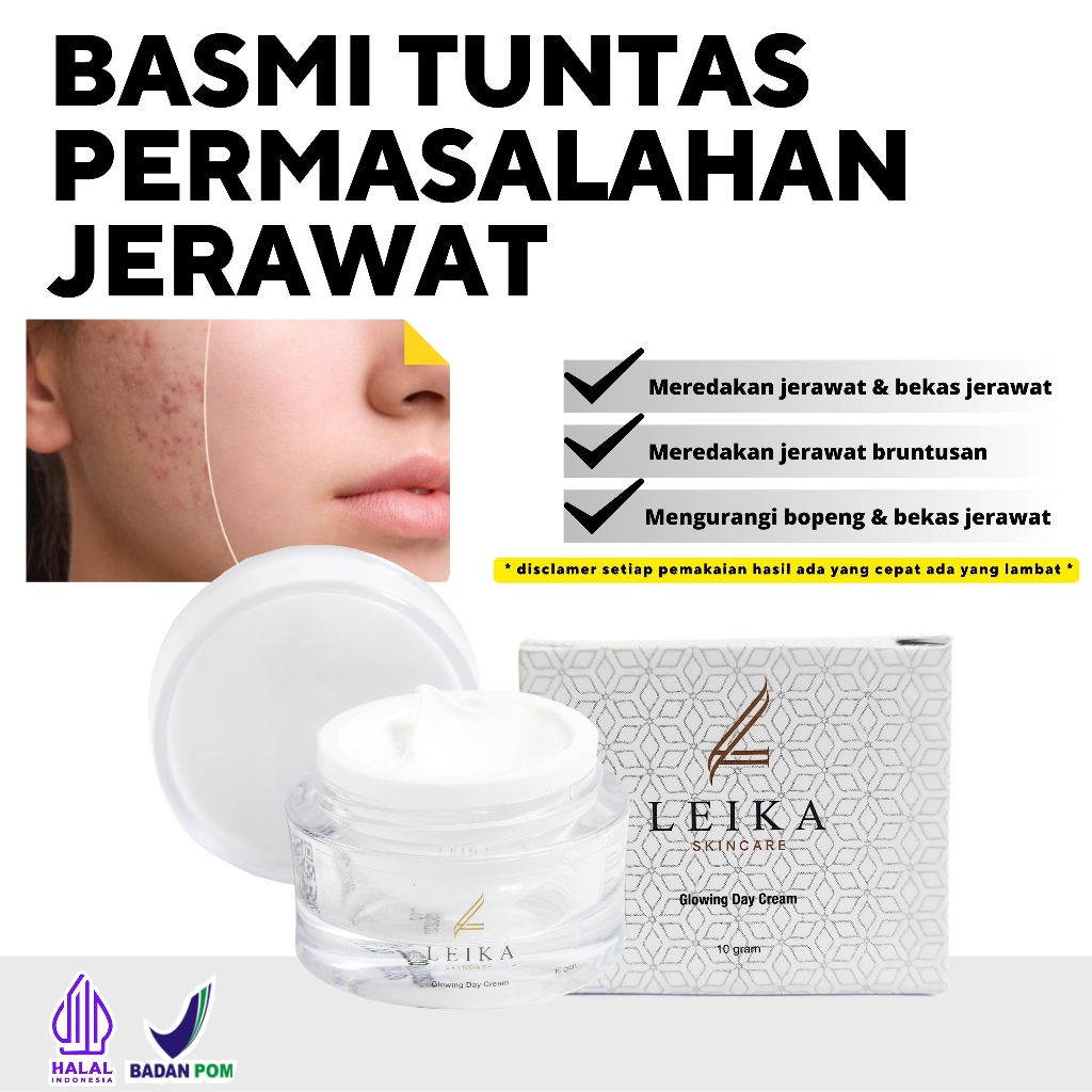 AMPUH Cream penghilang bekas jerawat pria Khusus bekas jerawat Perawatan jerawat meradang Perawatan 