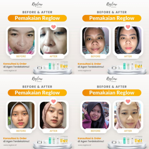 PROMO 11.11 Reglow Paket Perfect Glowing Facial Wash Day Night Cream Serum Toner dr Shindy Skincare Original Official