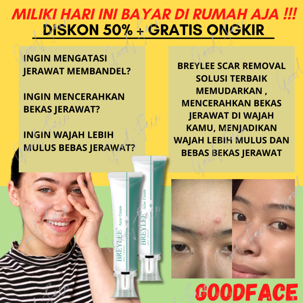 Penghilang Bekas Jerawat BREYLEE Acne Cream Scar Removal Penghilang Noda Bekas Jerawat, Luka &amp; Stretch Mark (30 g)