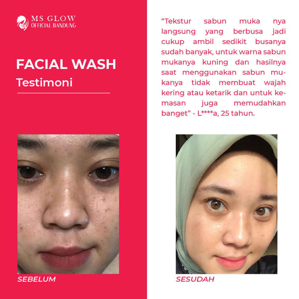 Facial Wash / Sabun Cuci Muka Ms Glow Perawatan Wajah Termurah - By Msglowofficialbandung