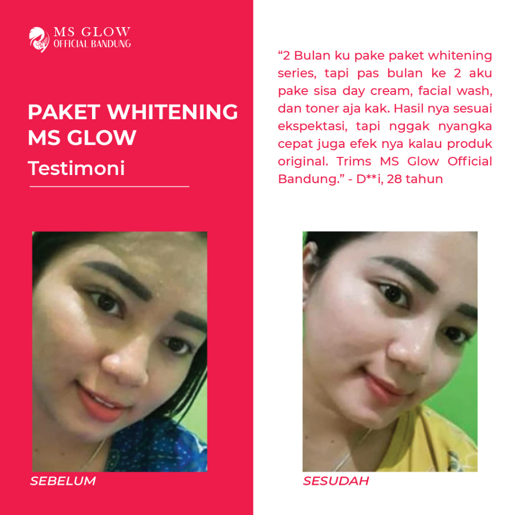 Ms Glow Original Paket Whitening Pemutih Wajah &amp; Perawatan Kecantikan - By Msglowofficialbandung