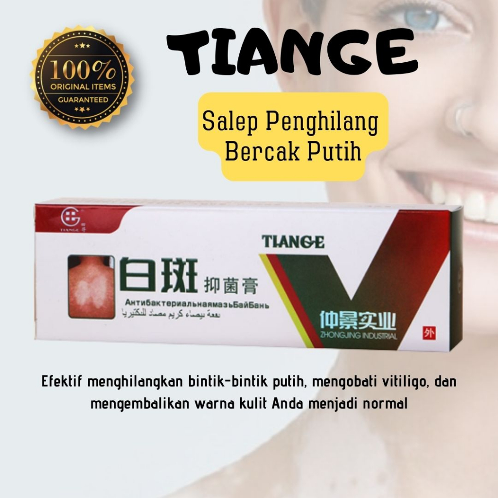 Salep Vitiligo Salep Tiange Penghilang Bercak Putih Bintik Putih