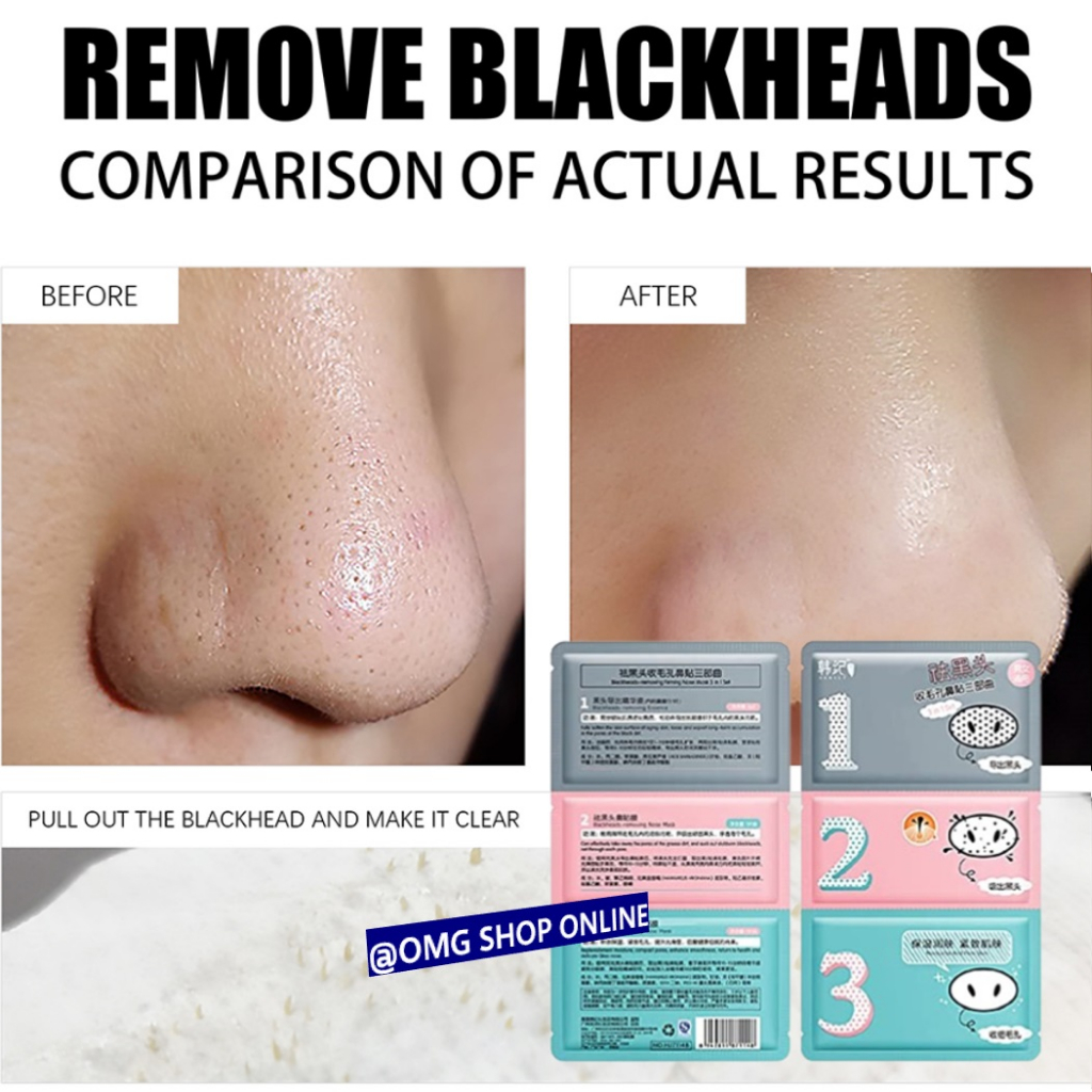 [NEW] Termurah !!! Masker Wajah 3 Step in 1 Remove Blackhead Masker Hidung Penghilang Komedo / Sheet Mask Pembersih Komedo Masker Wajah Hidung Pencabut Komedo Skincare Masker Peel Off Anti Komedo Masker Gelatin / Masker Komedo Ampuh Masker Hidung Jerawat