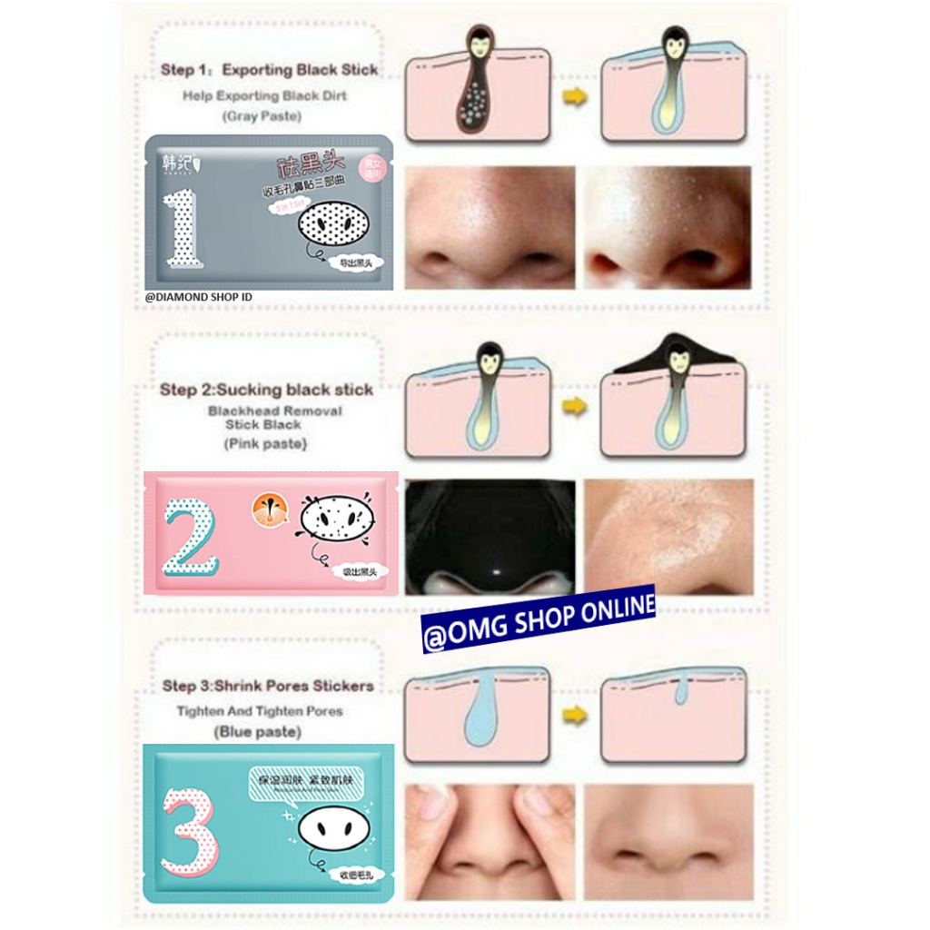 [NEW] Termurah !!! Masker Wajah 3 Step in 1 Remove Blackhead Masker Hidung Penghilang Komedo / Sheet Mask Pembersih Komedo Masker Wajah Hidung Pencabut Komedo Skincare Masker Peel Off Anti Komedo Masker Gelatin / Masker Komedo Ampuh Masker Hidung Jerawat