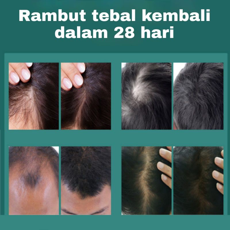 HELLSE SHAMPO HERBAL UNTUK RAMBUT RONTOK 500Ml