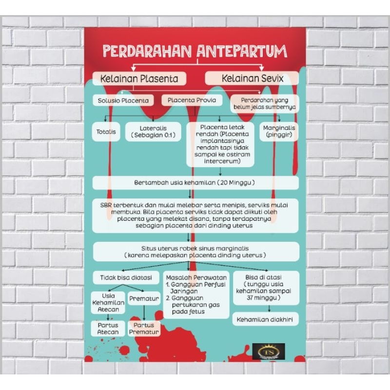 

Poster Kebidanan Tentang Perdarahan Antepartum