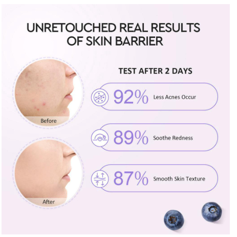 (BPOM) Glad2Glow 5% Blueberry Moisturizer Cream 5x Ceramide Skin Barrier Repair 25gr/Pelembab wajah/Moisturizer pencerah wajah