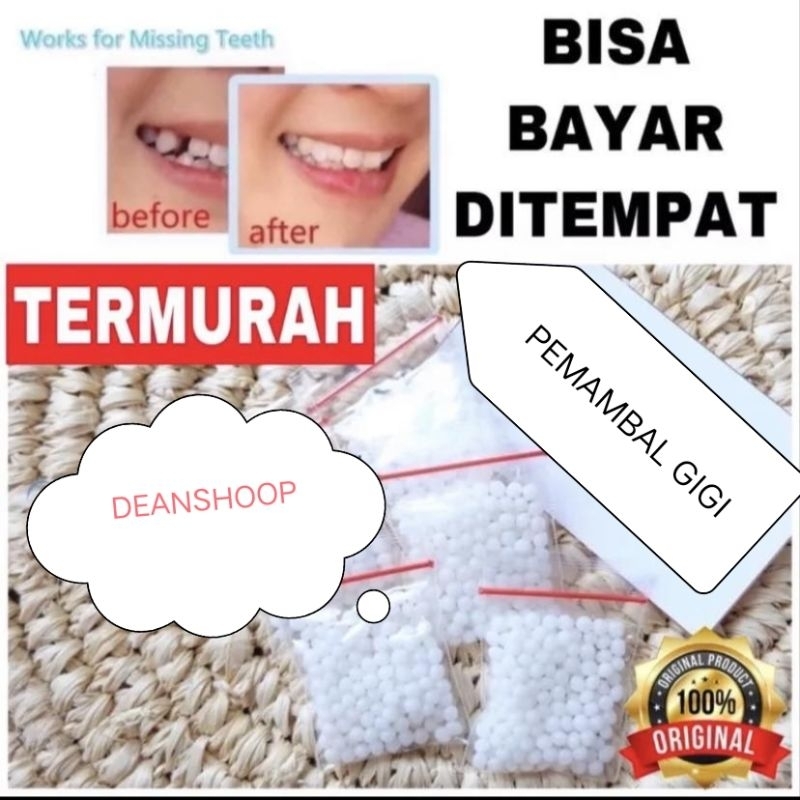 ￼TERMURAH   TEMPTOOTH GIGI PALSU SEMENTARA PENAMBAL GIGI PATAH RENGGANG / TEMTOOTH / BAHAN TAMBAL GI