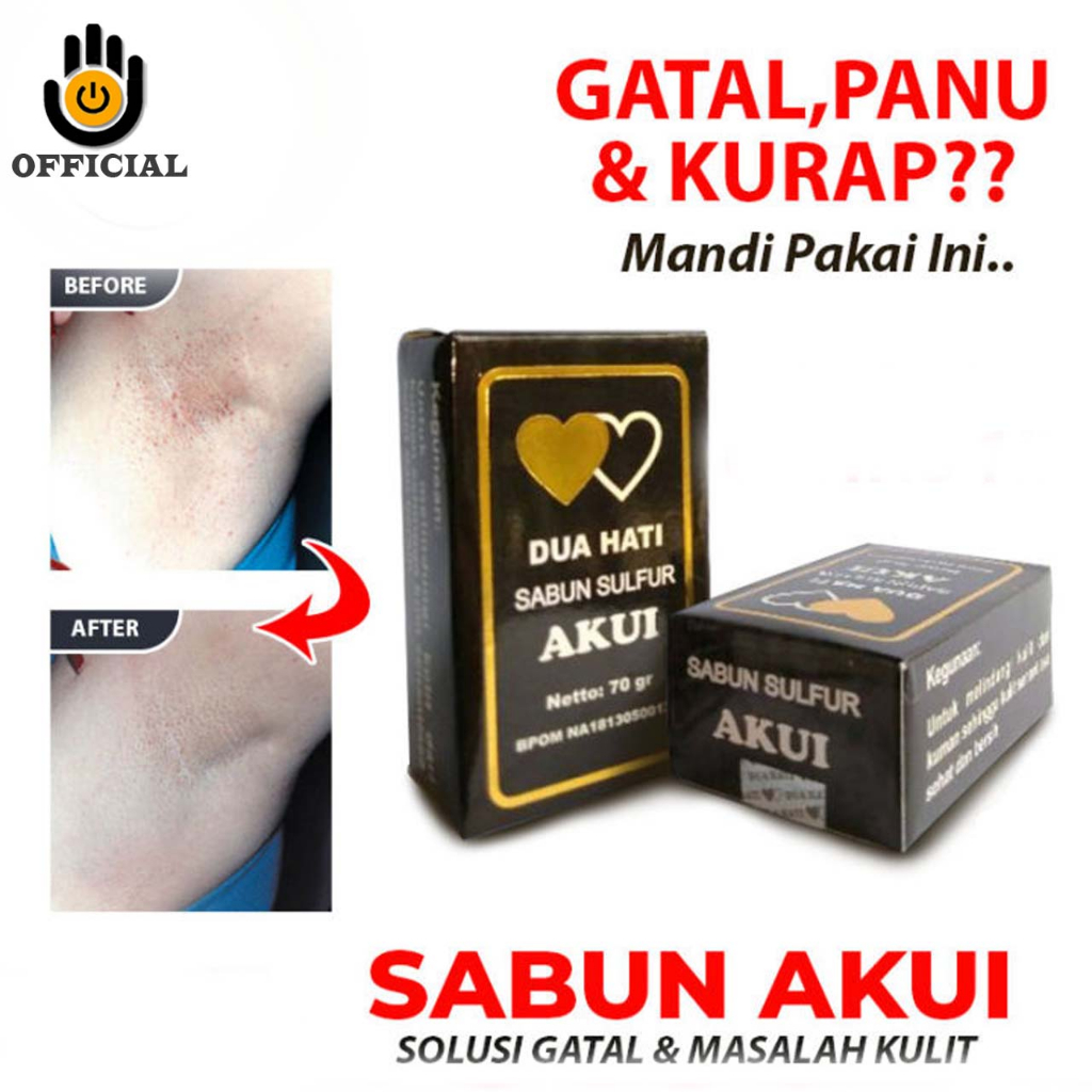 Sabun Gatal AKUI Sulfur Belerang /Sabun Belerang /Sabun Gatal Kurap Kudis Kadas - Sabun Akui Original