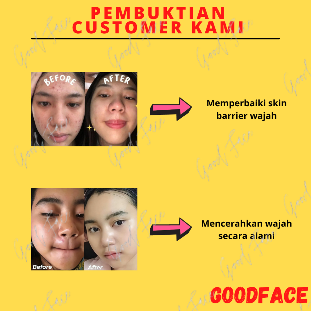 Masker Wajah Penghilang Jerawat BREYLEE ALOE VERA | PERILLA | ORANGE BLOSSOM | TEA TREE CLAY MASK - (1pc)