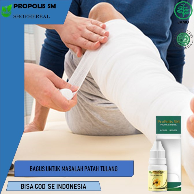 Obat Patah Tulang, Keropos Tulang, Pengapuran Tulang -