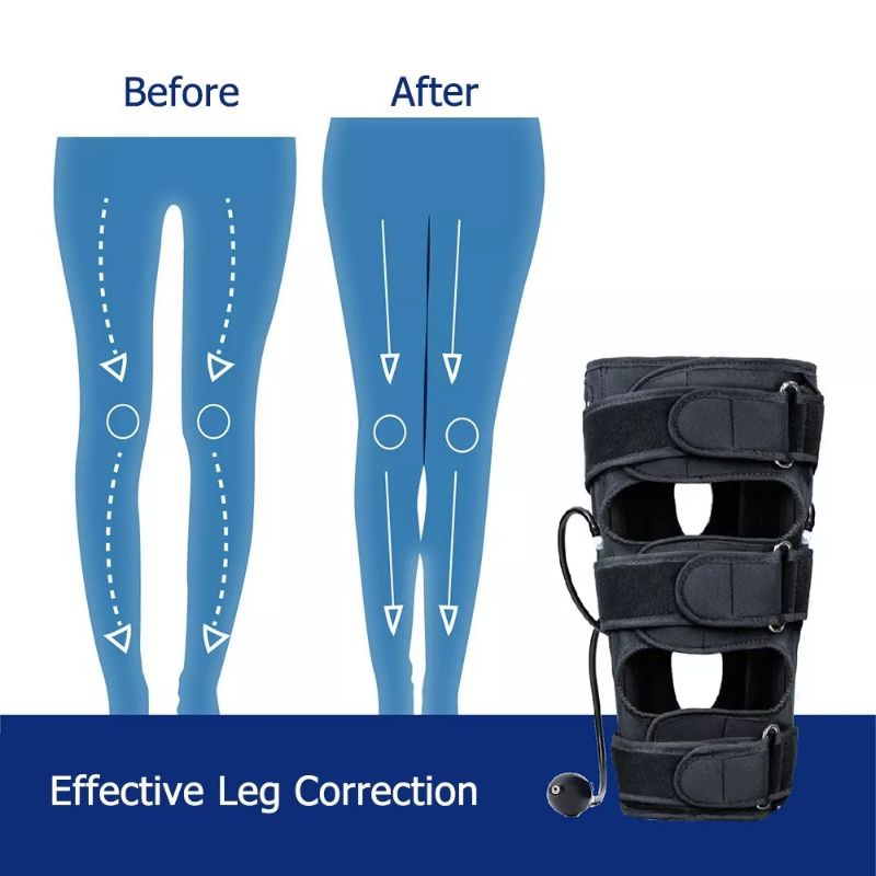 Aurabaik Alat Meluruskan Kaki Leg Correction Terapi X Pelurus Kaki O X Kaki X O