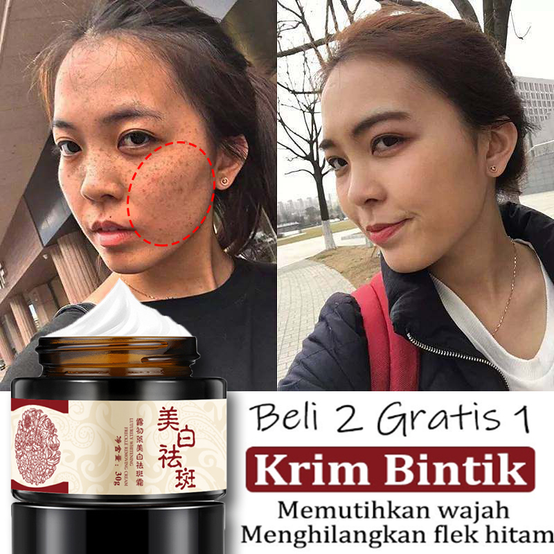 (100% asli)Krim pemutih Krim bintik Penghilang flek hitam Diwajah Menghilangkan Melanin Pemutih Kola