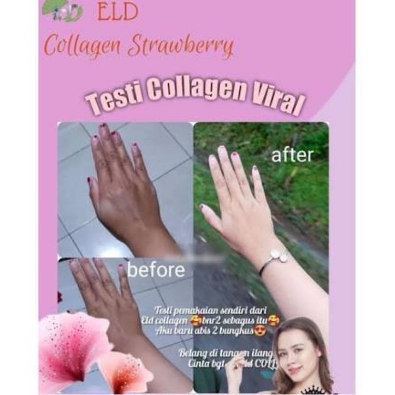 Minuman Kesehatan (UBC)/  ELD Collagen Drink Strawberry
