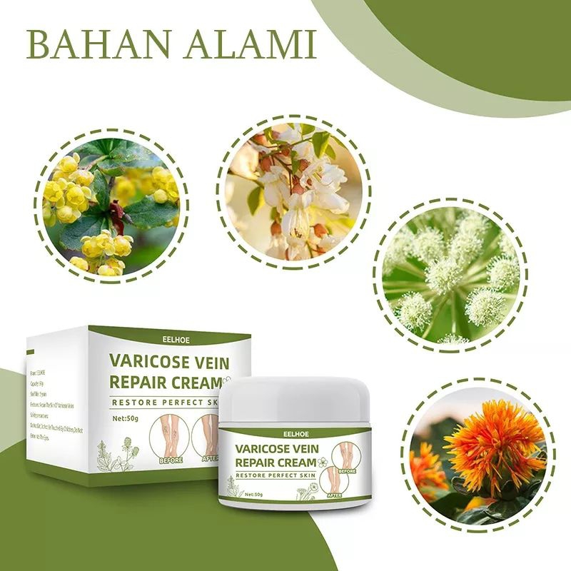 [COD] Cream varises alami | cream menyembuhkan varises