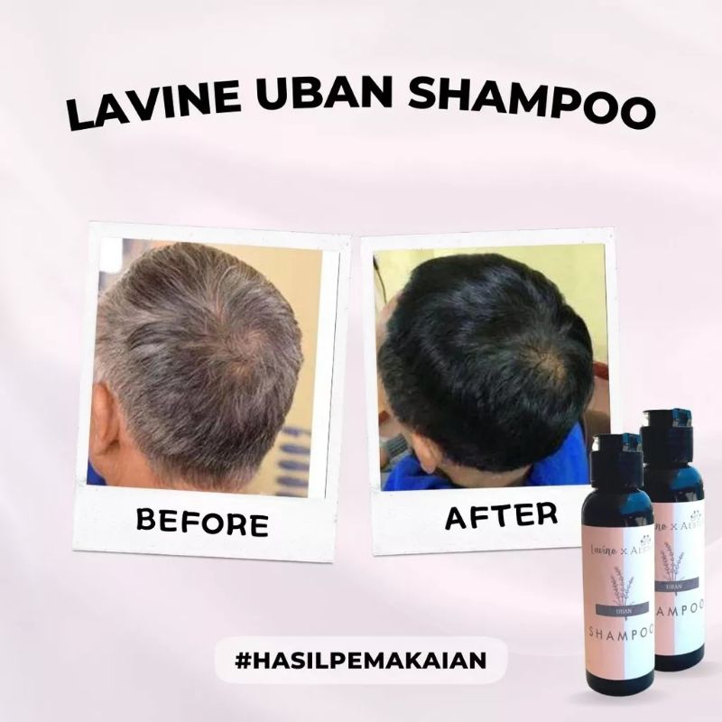 Lavine shampo uban | Shampo lavine menghilangkan uban permanen