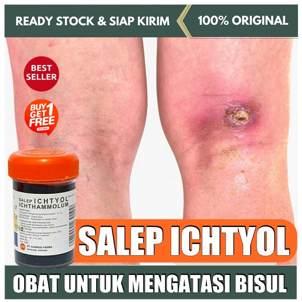 BELI 1 GRATIS 1 salep ichtyol hitam obat bisul tanpa mata pereda nyeri bisul penghilang bisul origin