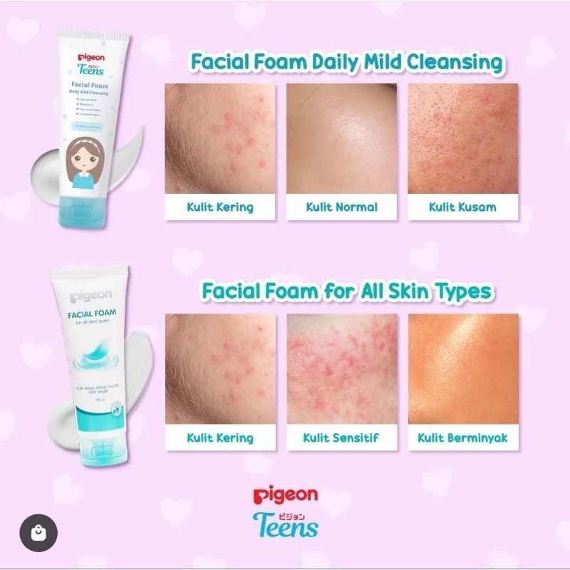 PIGEON TEENS Facial Foam Acne Care | All Skin Type | Deep Cleansing &amp; Oil Control | Daily Mild Cleansing | Sabun Cuci Muka Pigeon | Pembersih Wajah