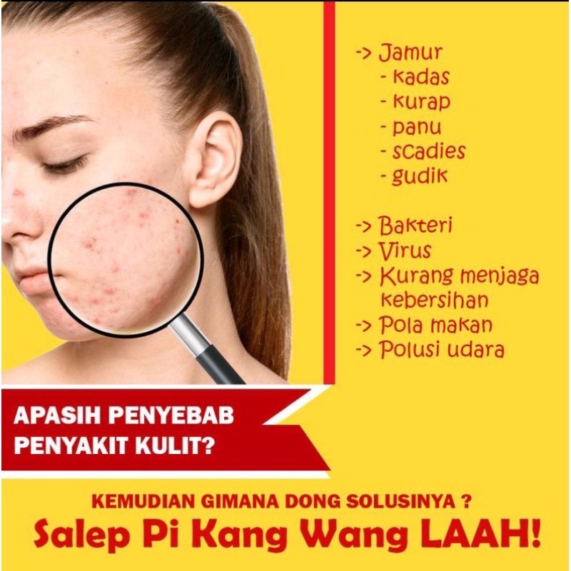 salep BL asli Original 100% Untuk Menghilangkan Gatal gatal dan Flek flek Hitam Salep Gatal