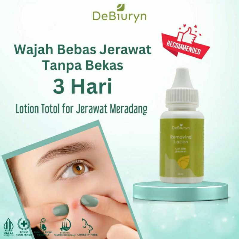 DEBIURYN REMOVIND LOTION 30ML | Lotion Anti Jerawat