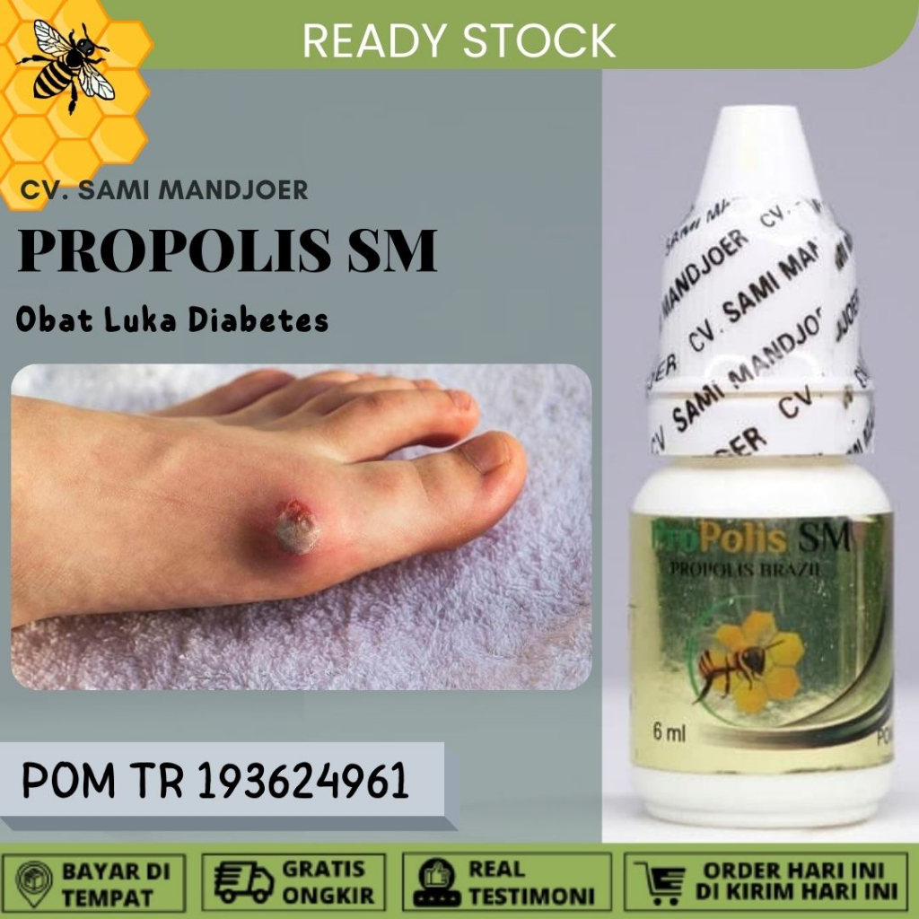 Obat Luka Diabetes Luka Diabetes Basah dan Kering Luka Diabetes Bernanah Obat Luka Diabetes Agar Cep