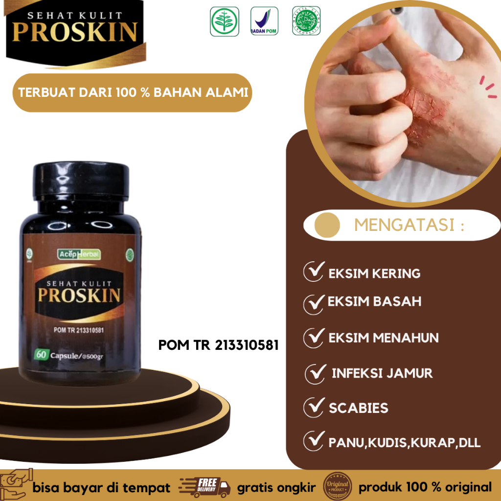 Obat eksim, Obat Gatal Eksim Kering Basah, Obat Exsim di kaki, Obat Eksim Gatal, Obat Eksim Kering ,