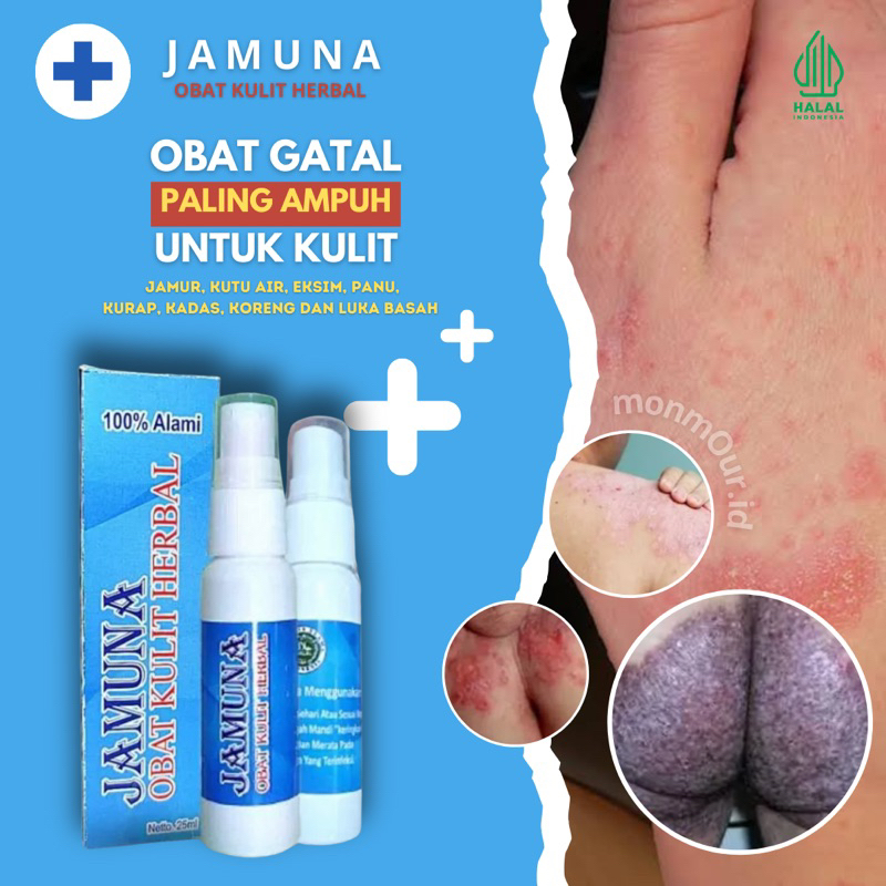 OBAT GATAL PALING AMPUH - Obat Gatal Gatal Di Seluruh Badan - Jamuna Spray , Gatal Alergi , Infeksi 