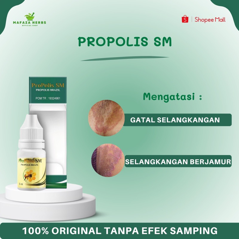 Obat Gatal Selangkangan, Obat Selangkangan Hitam dan Gatal, Obat Kurap Selangkangan, Obat Penghilang