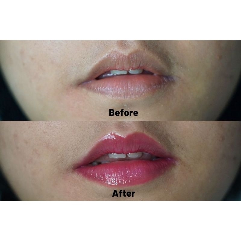 LIPPIE SERUM BY RAECCA